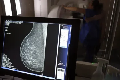 Plano de saúde terá que cobrir mamografia digital para todas as idades